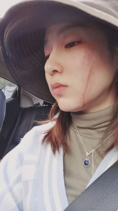 怎么形容疤痕