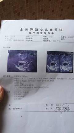 多囊怀孕
