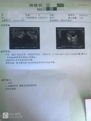 白带褐色是怀孕吗