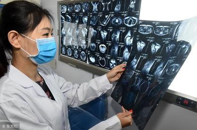 脑白质缺血灶怎么治疗