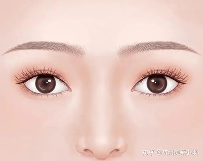割双眼皮眼型