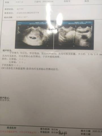 怀孕40天能看出男女吗