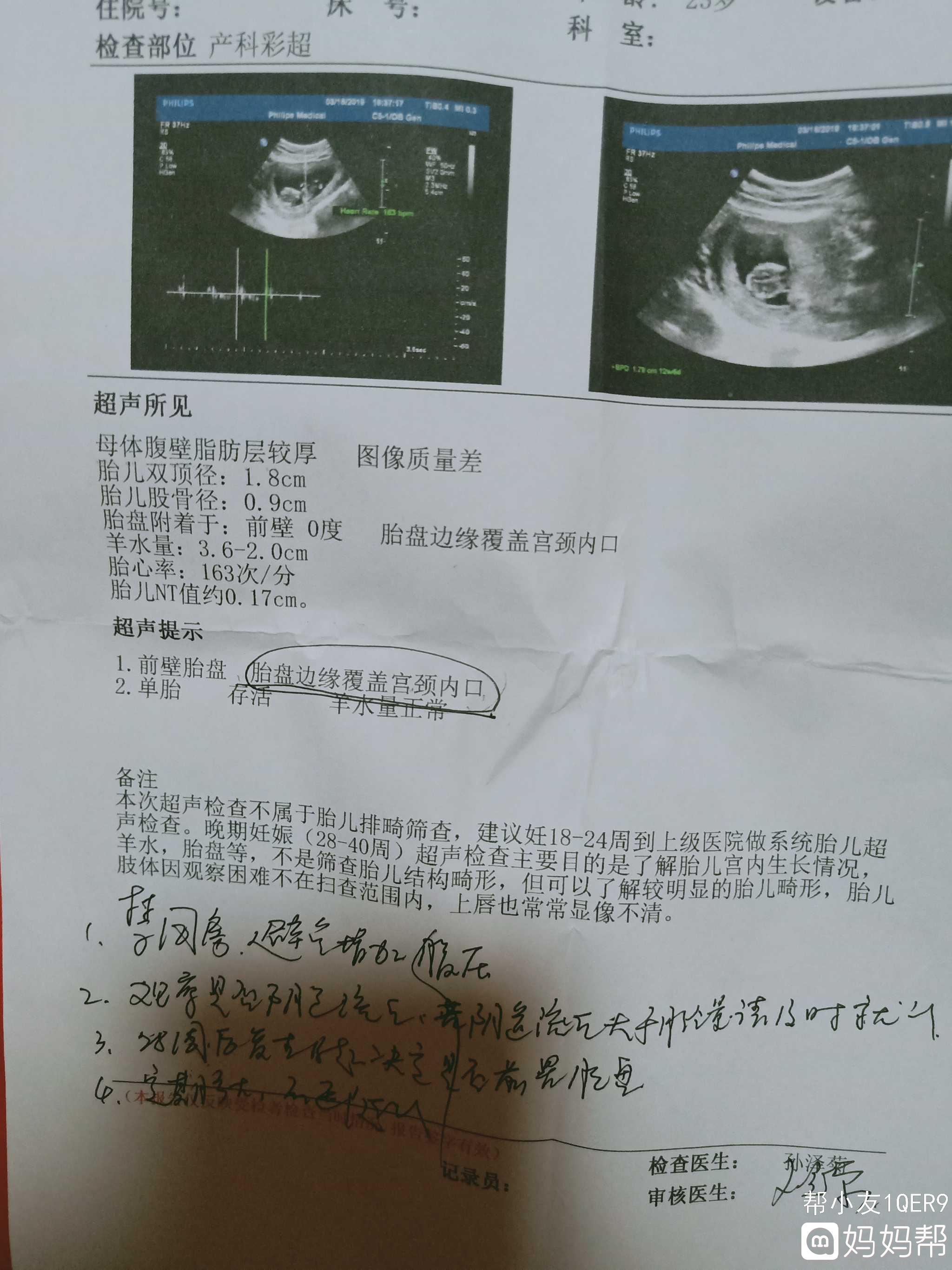 孕妇胎盘低是什么原因