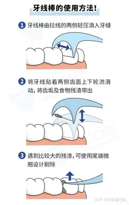 洗牙后牙龈萎缩