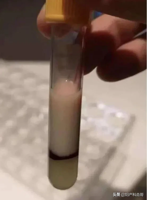 咳嗽可以吃鹅吗