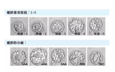 3bc囊胚相当于多少分