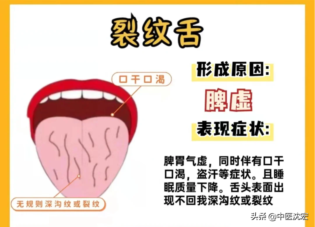 喉咙有红点是怎么回事