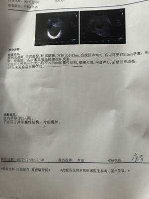 怀孕七个月能打胎吗