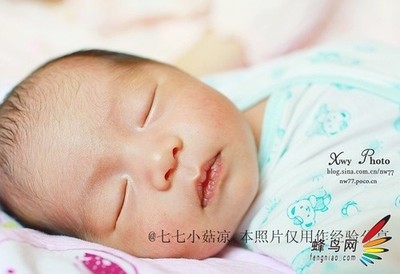 新生儿眼底