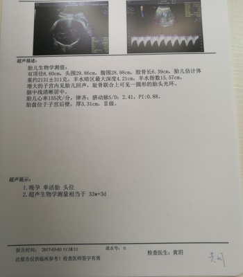 足月胎儿股骨长标准