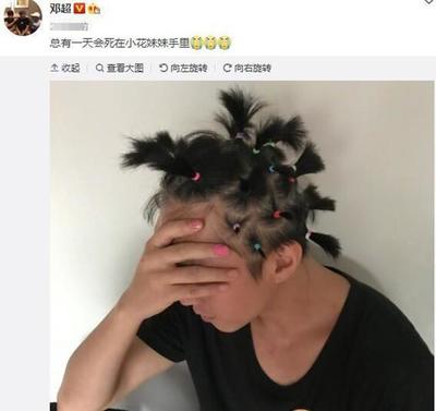 扎马尾头疼怎么回事
