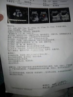 小排畸有宝宝照片吗