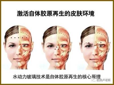 除皱原理
