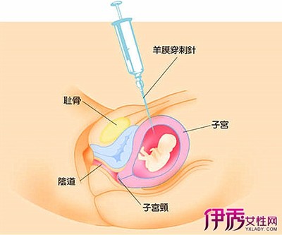 产前dna亲子鉴定