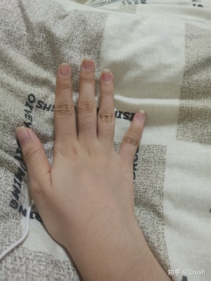 男人手指粗短是什么命