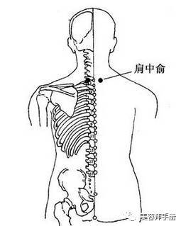 肩中俞疼是怎么回事