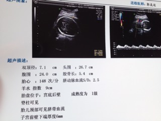 怀孕28周胎儿多大