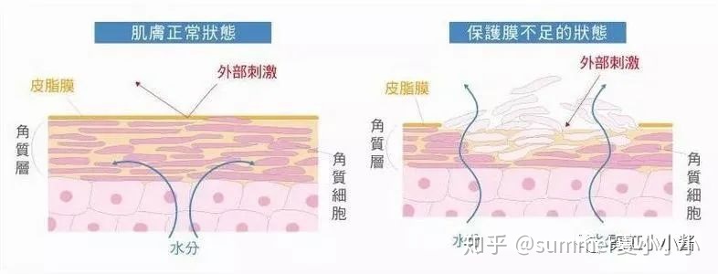 怎么判断自己是干皮还是油皮痘痘