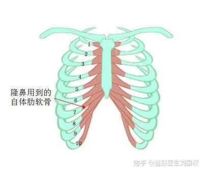 半肋骨隆鼻有后遗症吗