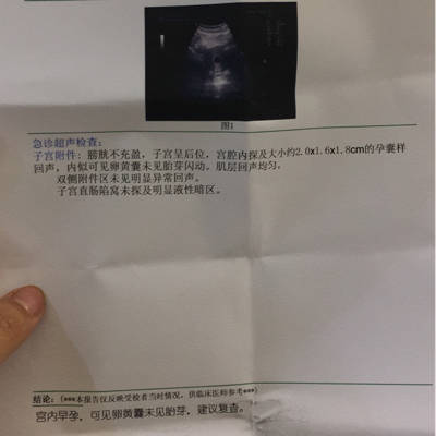 怀孕十几天怎么打胎