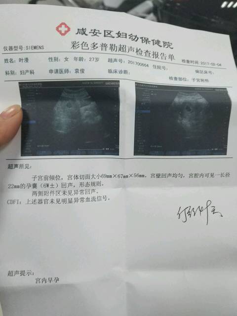 怀孕50天做什么检查