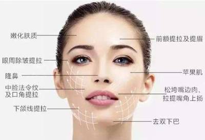 脸部提拉怎么做