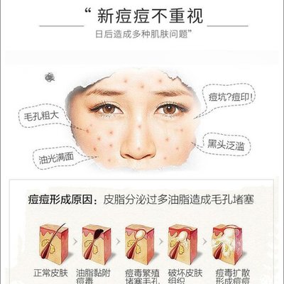 痘痘肌肤用什么牌子最好