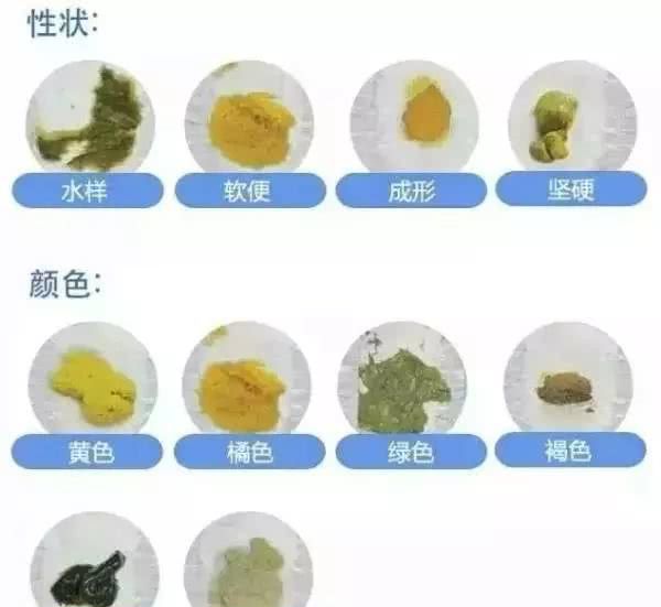 宝宝便便颜色