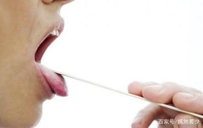 西瓜霜孕妇可以用吗