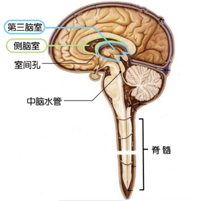 脑子有积液是怎么回事