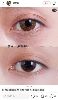 不会长脂肪粒的眼霜