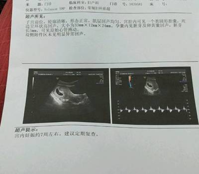 怀孕7周有胎心胎芽吗