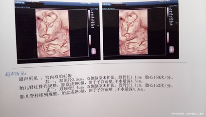 怀孕2个月发烧了怎么办