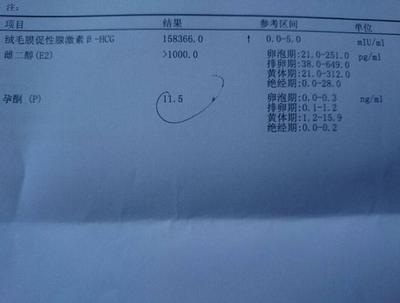 怀孕一个月可以做亲子鉴定吗