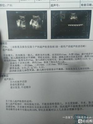 怀孕胎盘低置怎么办