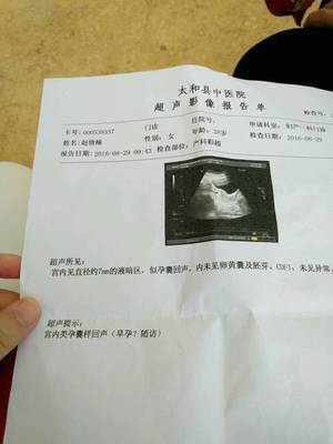 怀孕3个月孕囊多大