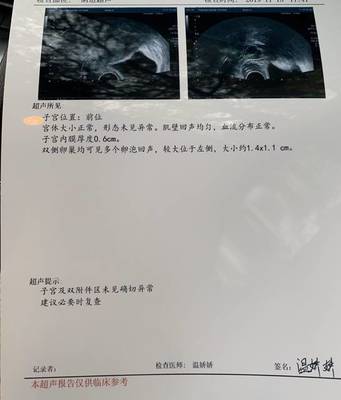 卵泡一个月有几个