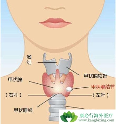 颈部结节怎么治疗