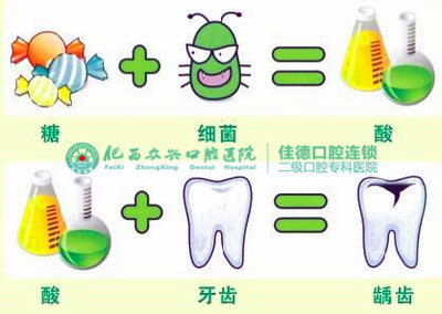 蛀牙怎么治疗