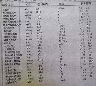 全身化验血要多少钱