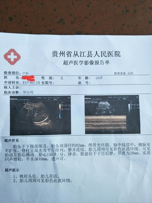 胎儿畸形能检查出来吗