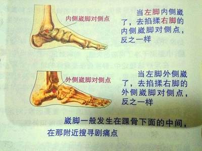 脚内侧疼是怎么回事