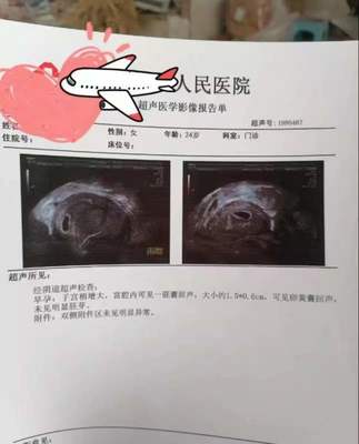 打胎需要谁签字