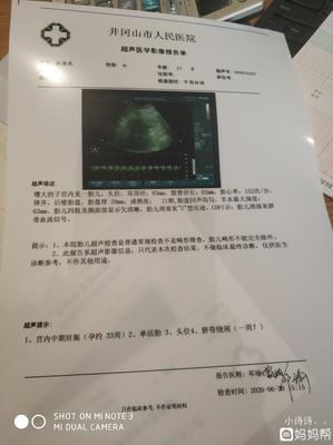 多少周足月可以生宝宝