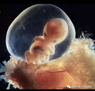 胎儿智障能检查出来吗
