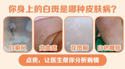 腋下有白斑是怎么回事