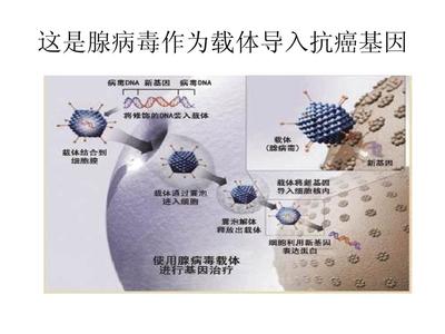 腺病毒怎么治疗效果好
