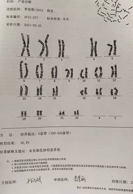 染色体平衡易位孕9个月