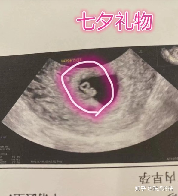 精子液化时间长怎么治疗