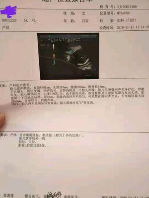 胎儿32周脐带绕颈一周怎么办